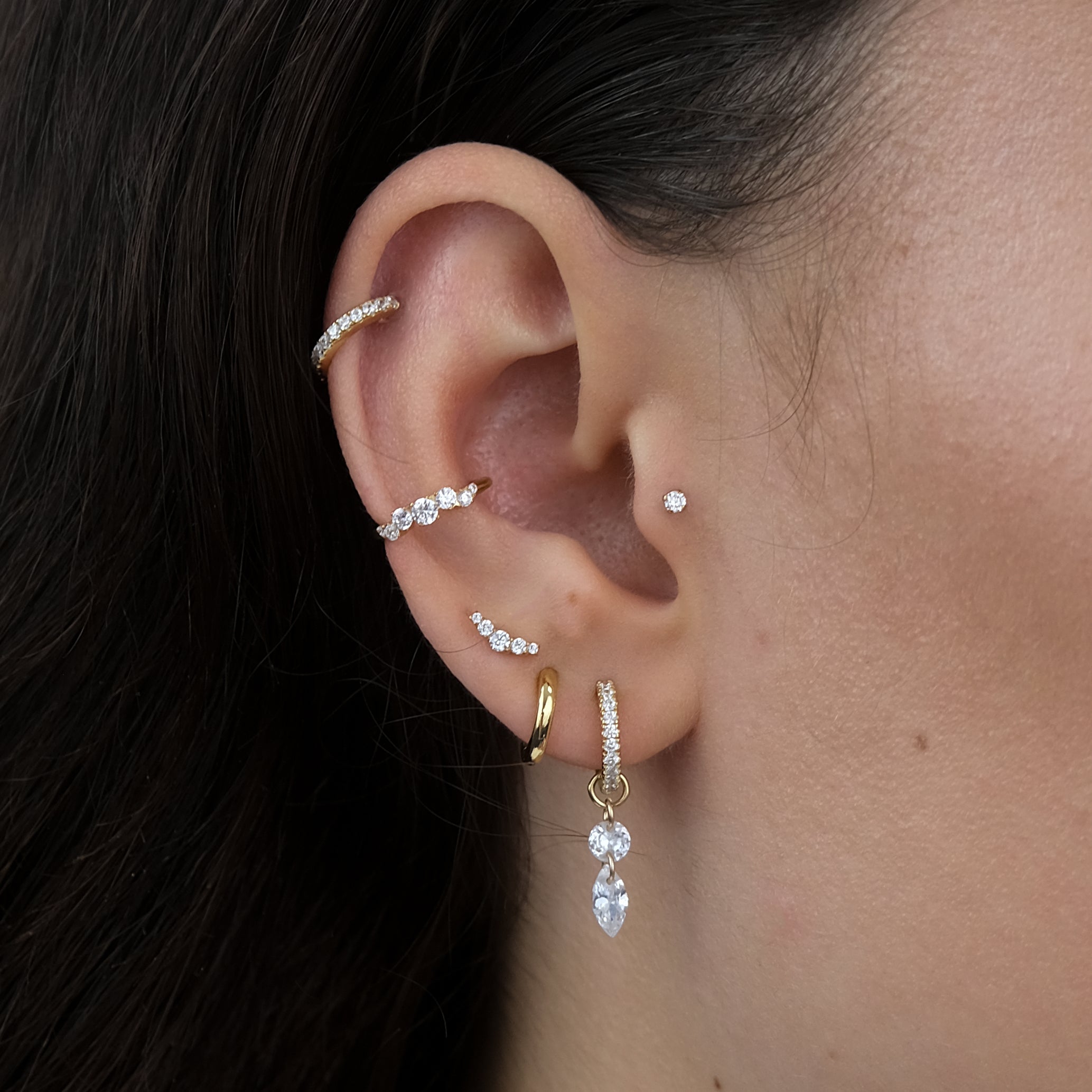 ASTRA Cartilage Hoop (10mm)